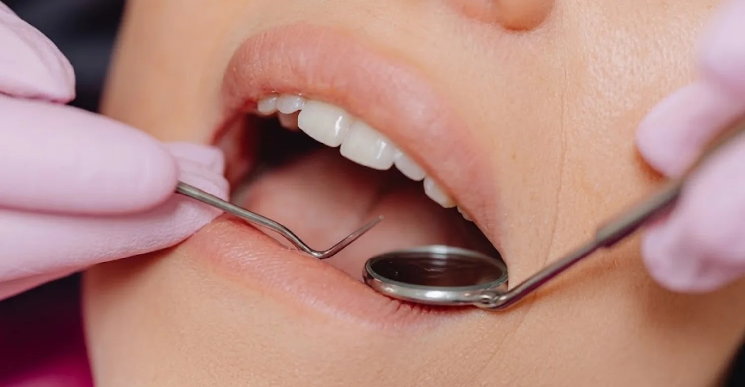Black Spot Inside Your Cheek 2
